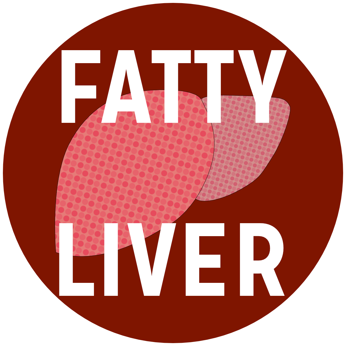 Fatty Liver Disease treatment